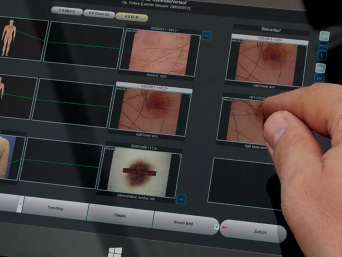 Screenshot 10 of MoleMax Systems